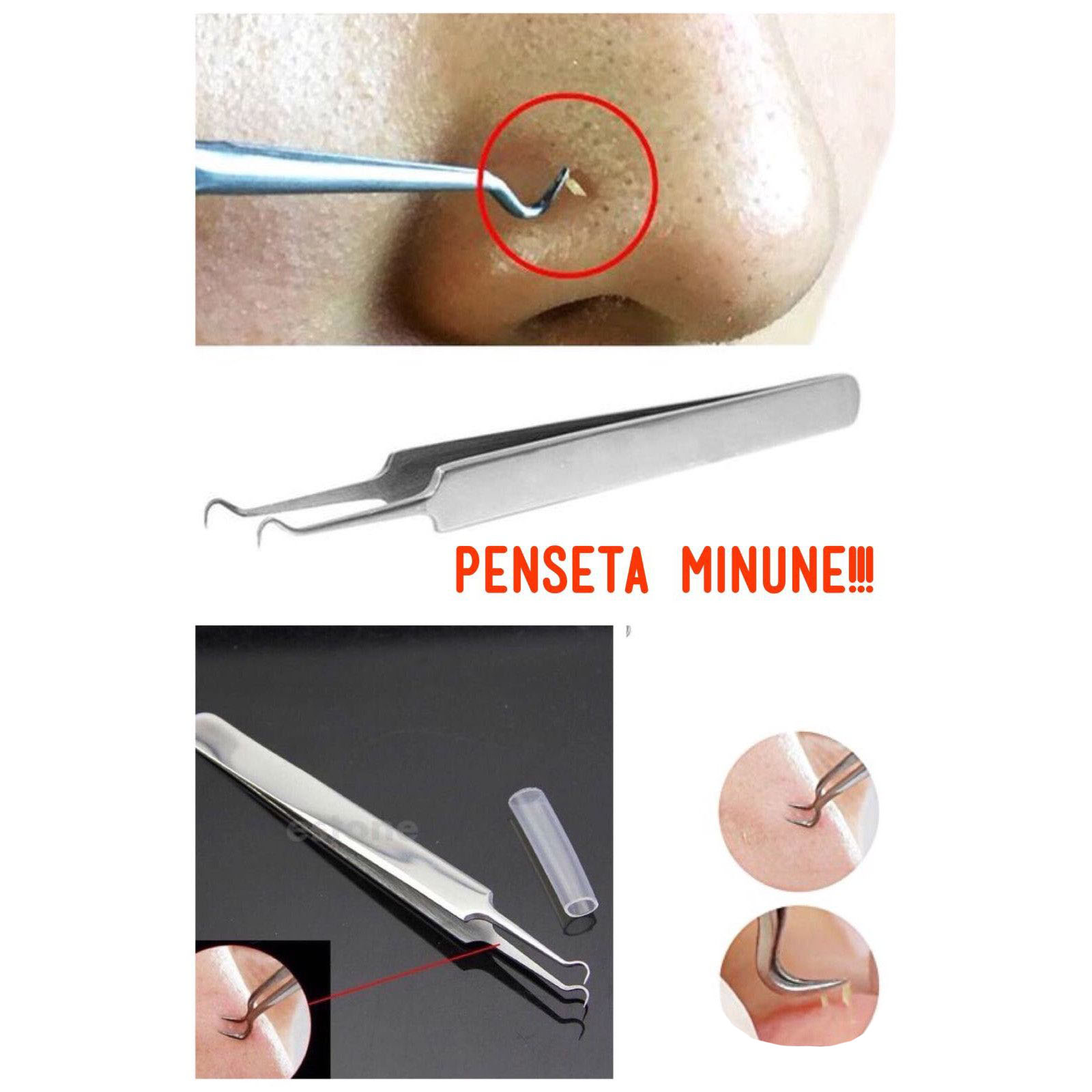 penseta puncte negre